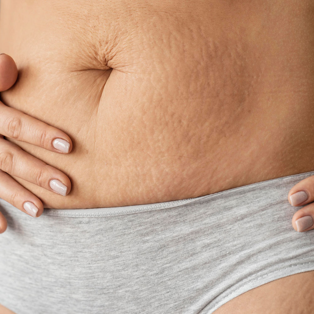 Traitement V-DERM au Havre