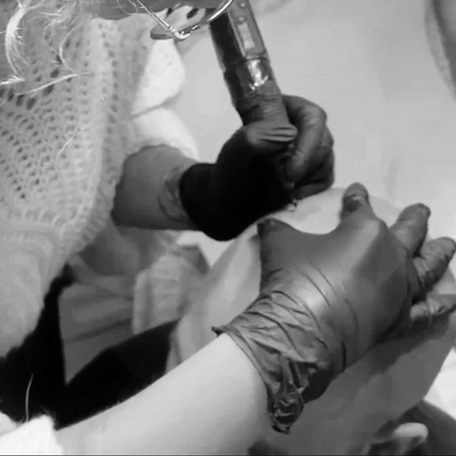 Tricopigmentation au Havre