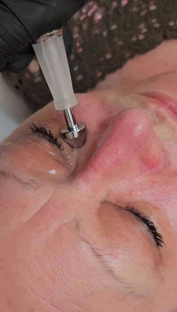 Mésothérapie virtuelle au Havre