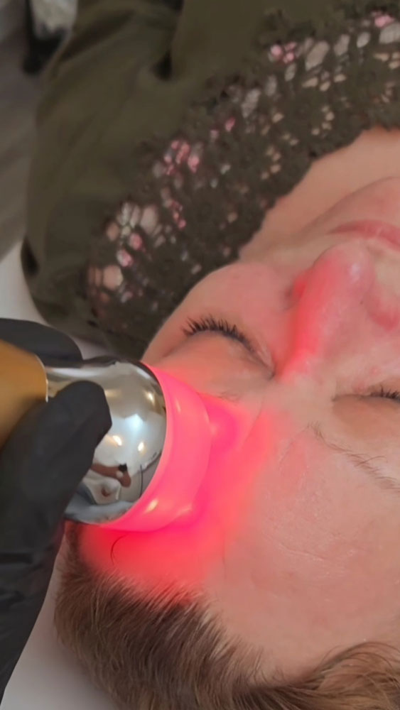 Mésothérapie virtuelle au Havre 