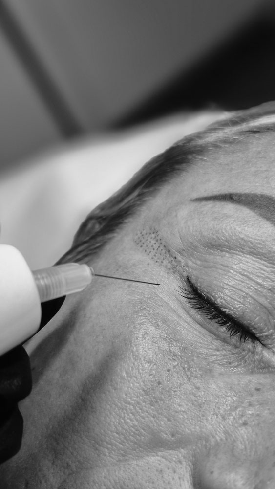 Skin thérapie au Havre